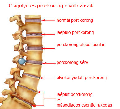 Gerinc elváltozásai